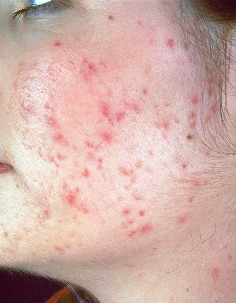 Affronti il pacco per purificazione di faccia